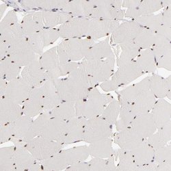 Invitrogen SIX1 Polyclonal Antibody 100 &mu;L | Buy Online | Invitrogen&trade; | Fisher Scientific