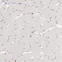 Invitrogen SIX1 Polyclonal Antibody 100 &mu;L | Buy Online | Invitrogen&trade; | Fisher Scientific