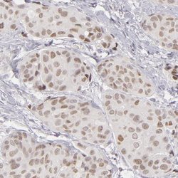 Invitrogen SIX1 Polyclonal Antibody 100 &mu;L | Buy Online | Invitrogen&trade; | Fisher Scientific