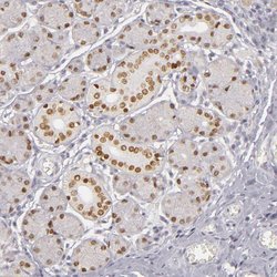 Invitrogen SIX1 Polyclonal Antibody 100 &mu;L | Buy Online | Invitrogen&trade; | Fisher Scientific