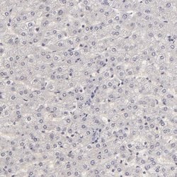 Invitrogen SIX1 Polyclonal Antibody 100 &mu;L | Buy Online | Invitrogen&trade; | Fisher Scientific