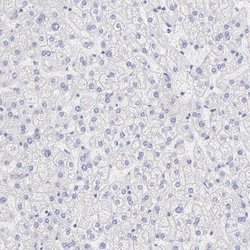 Invitrogen FARSA Polyclonal Antibody 100 &mu;L; Unconjugated:Antibodies,