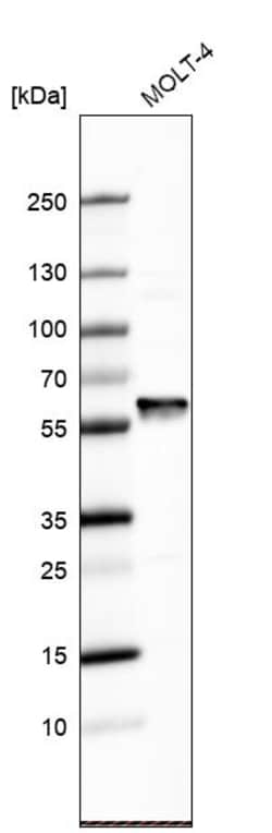Invitrogen FARSA Polyclonal Antibody 100 &mu;L; Unconjugated:Antibodies,