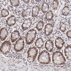Invitrogen TFAP4 Polyclonal Antibody 100 &mu;L; Unconjugated:Antibodies,