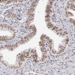 Invitrogen TFAP4 Polyclonal Antibody 100 &mu;L; Unconjugated:Antibodies,
