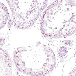 NFE2 Polyclonal Antibody:Antibodies, Polyclonal