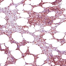 NFE2 Polyclonal Antibody:Antibodies, Polyclonal