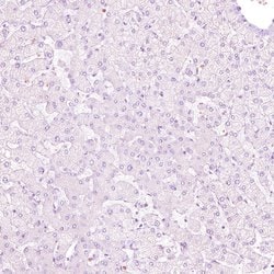 NFE2 Polyclonal Antibody:Antibodies, Polyclonal