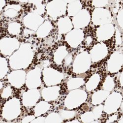 NFE2 Polyclonal Antibody:Antibodies, Polyclonal