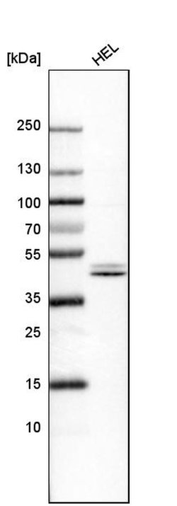 NFE2 Polyclonal Antibody:Antibodies, Polyclonal