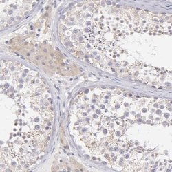 Invitrogen SH2D4A Polyclonal Antibody 100 &mu;L; Unconjugated:Antibodies,