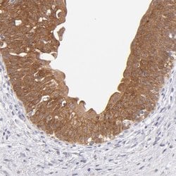 Invitrogen SH2D4A Polyclonal Antibody 100 &mu;L; Unconjugated:Antibodies,