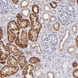 Invitrogen SH2D4A Polyclonal Antibody 100 &mu;L; Unconjugated:Antibodies,