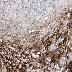 Invitrogen Fibulin 2 Polyclonal Antibody 100 &mu;L; Unconjugated:Antikörper