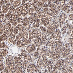 Invitrogen PPFIBP2 Polyclonal Antibody 100 &mu;L; Unconjugated:Antibodies,
