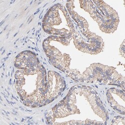 Invitrogen PPFIBP2 Polyclonal Antibody 100 &mu;L; Unconjugated:Antibodies,