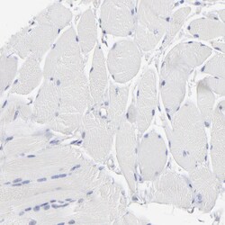 Invitrogen PPFIBP2 Polyclonal Antibody 100 &mu;L; Unconjugated:Antibodies,