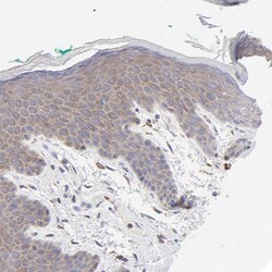 Invitrogen PPFIBP2 Polyclonal Antibody 100 &mu;L; Unconjugated:Antibodies,