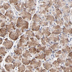 Invitrogen PPFIBP2 Polyclonal Antibody 100 &mu;L; Unconjugated:Antibodies,