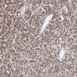 Invitrogen PPFIBP2 Polyclonal Antibody 100 &mu;L; Unconjugated:Antibodies,