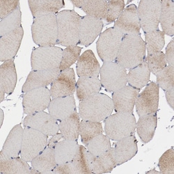 Invitrogen ERLIN2 Polyclonal Antibody 100 &mu;L; Unconjugated:Antibodies,