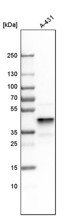 Invitrogen ERLIN2 Polyclonal Antibody 100 &mu;L; Unconjugated:Antibodies,