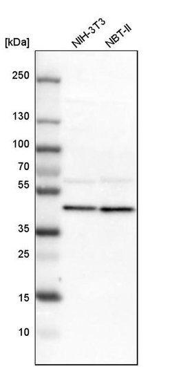 Invitrogen ERLIN2 Polyclonal Antibody 100 &mu;L; Unconjugated:Antibodies,