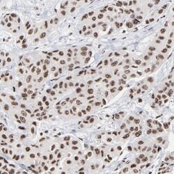 Invitrogen MBD4 Polyclonal Antibody 100 &mu;L; Unconjugated:Antibodies,