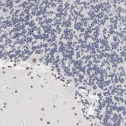 Invitrogen MBD4 Polyclonal Antibody 100 &mu;L; Unconjugated:Antibodies,