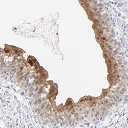 Invitrogen POF1B Polyclonal Antibody 100 &mu;L; Unconjugated:Antibodies,