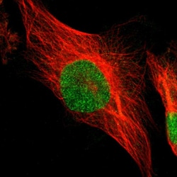 Invitrogen PSMC4 Polyclonal Antibody 100 &mu;L; Unconjugated:Antibodies,