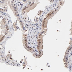 Invitrogen PSMC4 Polyclonal Antibody 100 &mu;L; Unconjugated:Antibodies,
