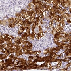 Invitrogen ARHGAP36 Polyclonal Antibody 100 &mu;L; Unconjugated:Antibodies,