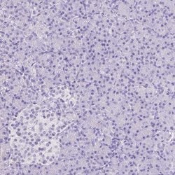Invitrogen ARHGAP36 Polyclonal Antibody 100 &mu;L; Unconjugated:Antibodies,