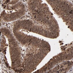 Invitrogen NXF2 Polyclonal Antibody 100 &mu;L; Unconjugated:Antibodies,