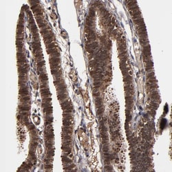 Invitrogen NXF2 Polyclonal Antibody 100 &mu;L; Unconjugated:Antibodies,