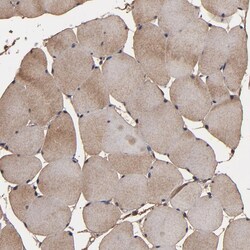 Invitrogen NXF2 Polyclonal Antibody 100 &mu;L; Unconjugated:Antibodies,