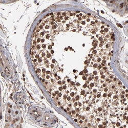 Invitrogen NXF2 Polyclonal Antibody 100 &mu;L; Unconjugated:Antibodies,