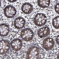 Invitrogen KIAA2026 Polyclonal Antibody 100 &mu;L; Unconjugated:Antibodies,