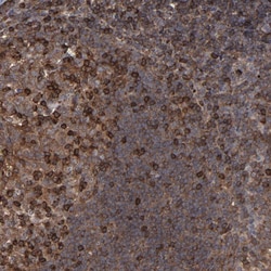 Invitrogen KIAA2026 Polyclonal Antibody 100 &mu;L; Unconjugated:Antibodies,