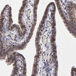Invitrogen KDM6A Polyclonal Antibody 100 &mu;L; Unconjugated:Antibodies,