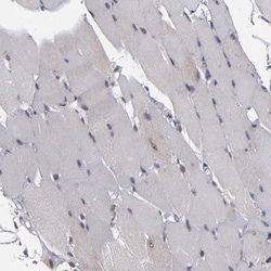 Invitrogen KDM6A Polyclonal Antibody 100 &mu;L; Unconjugated:Antibodies,