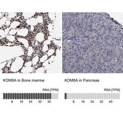 Invitrogen KDM6A Polyclonal Antibody 100 &mu;L; Unconjugated:Antibodies,