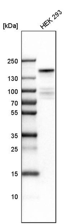 Invitrogen KDM6A Polyclonal Antibody 100 &mu;L; Unconjugated:Antibodies,