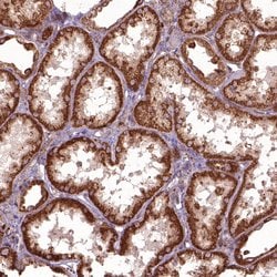 Invitrogen HYAL1 Polyclonal Antibody 100 &mu;L; Unconjugated:Antibodies,