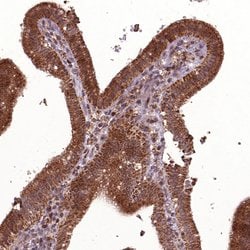 Invitrogen HYAL1 Polyclonal Antibody 100 &mu;L; Unconjugated:Antibodies,