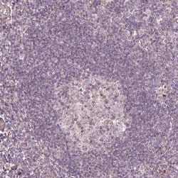 Invitrogen HYAL1 Polyclonal Antibody 100 &mu;L; Unconjugated:Antibodies,