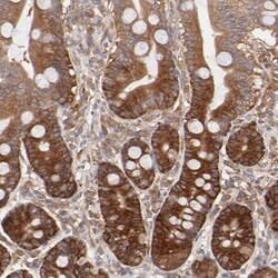 GART Polyclonal Antibody:Antibodies, Polyclonal