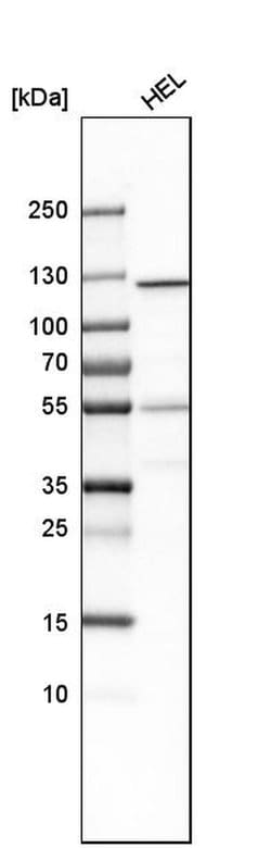 GART Polyclonal Antibody:Antibodies, Polyclonal