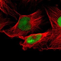 Invitrogen IFI16 Polyclonal Antibody 100 &mu;L; Unconjugated:Antibodies,